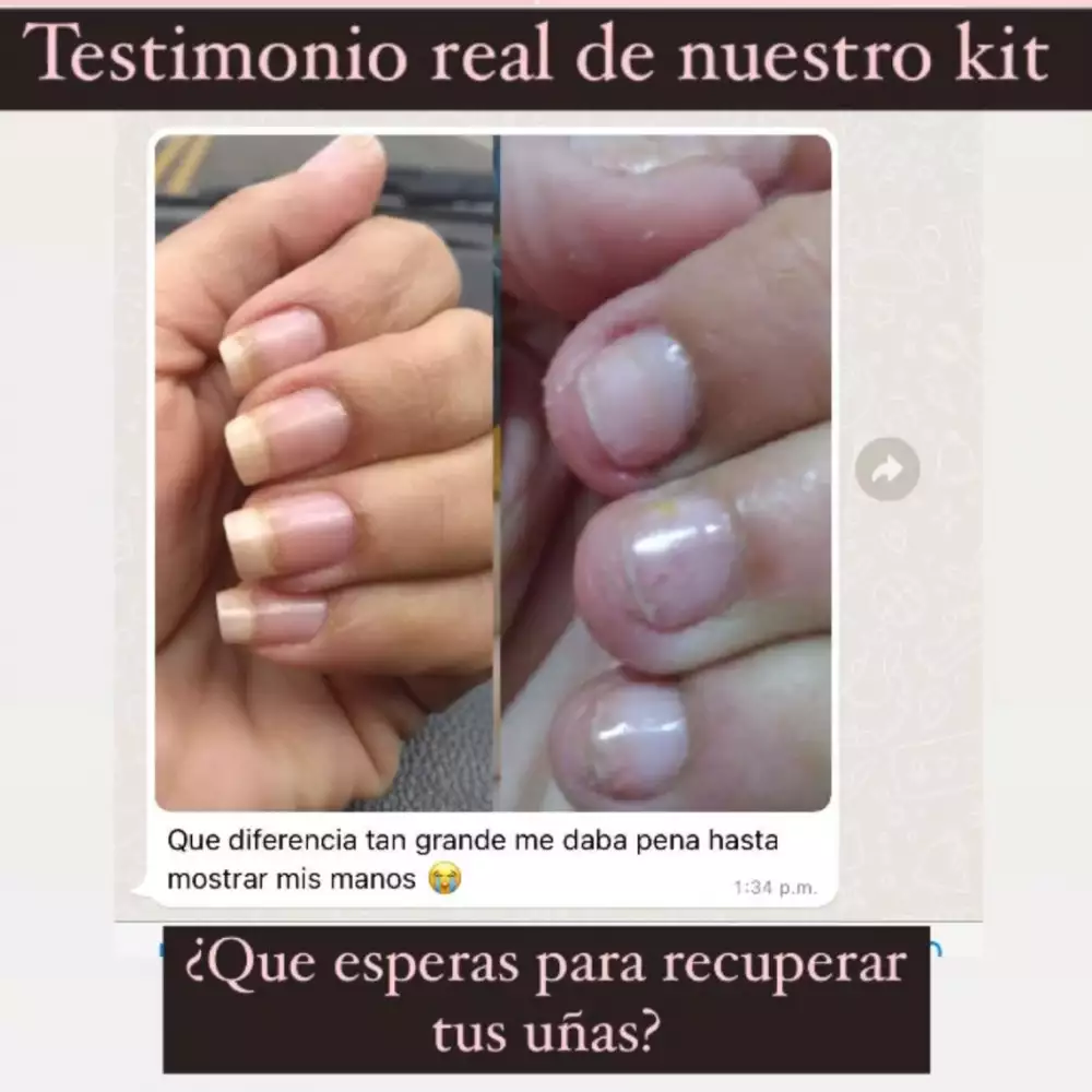 Base fortalecedora para uñas con vitaminas y biotin 30 ml