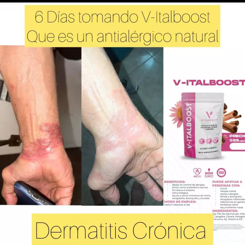Cápsulas V-Italboost inmunidad y alergias 60 unidades