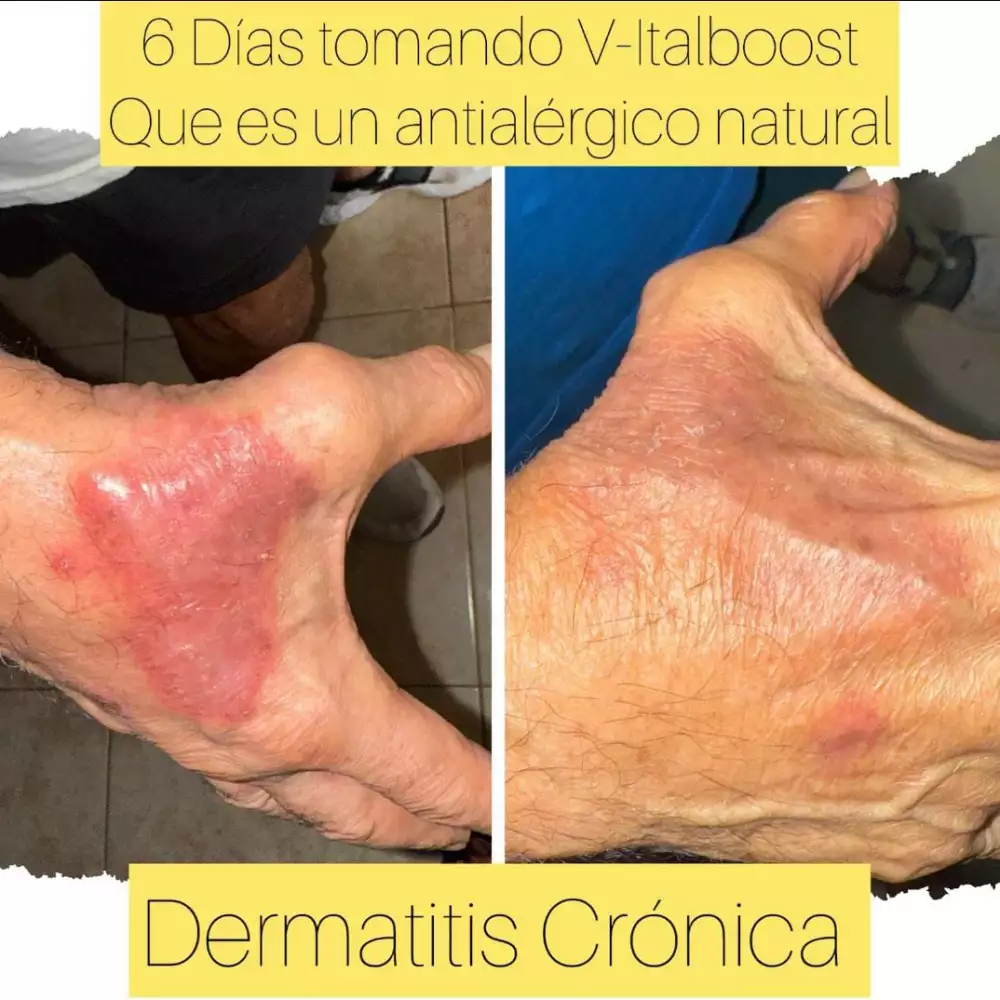 Cápsulas V-Italboost inmunidad y alergias 60 unidades