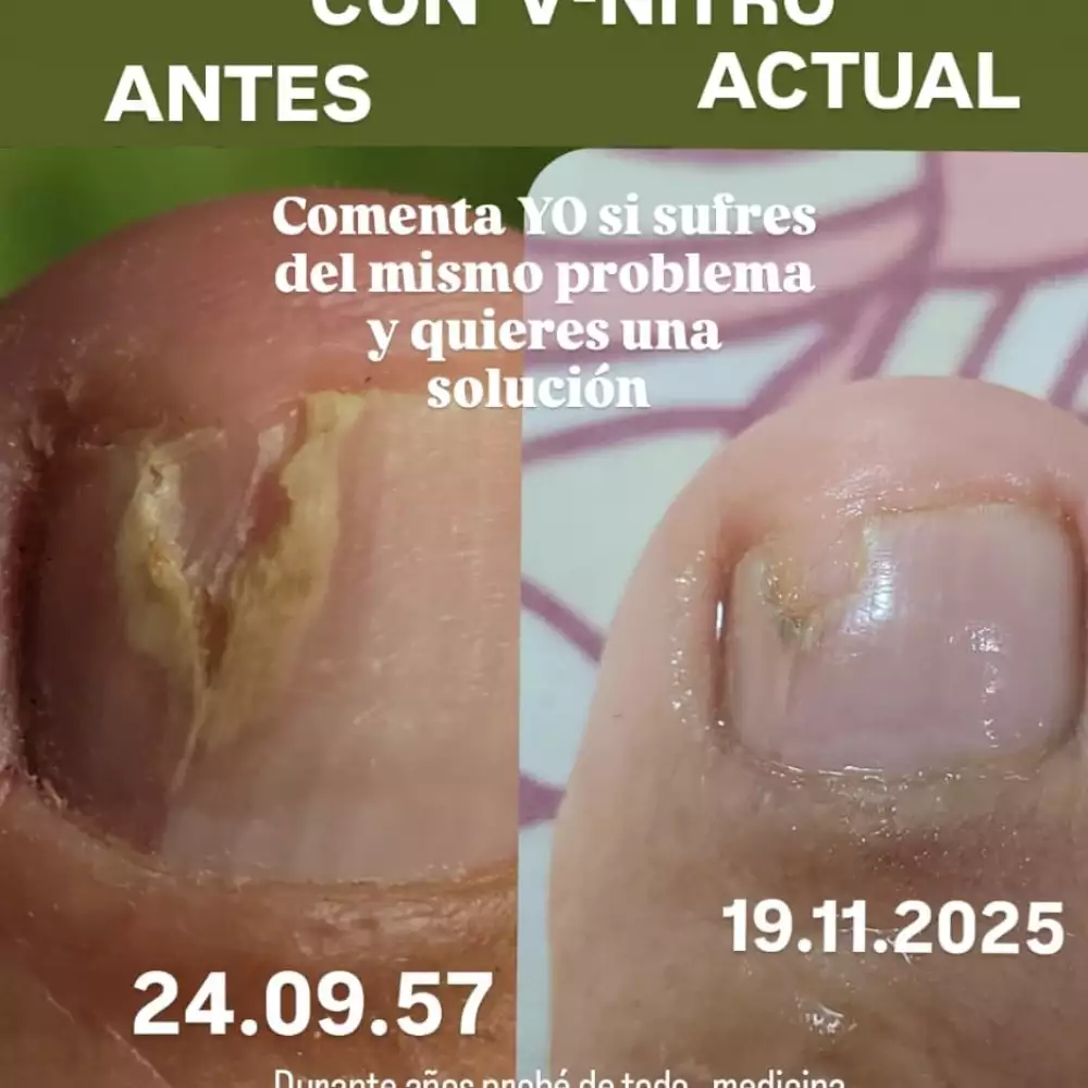 Suplemento líquido para circulación y salud cardiovascular