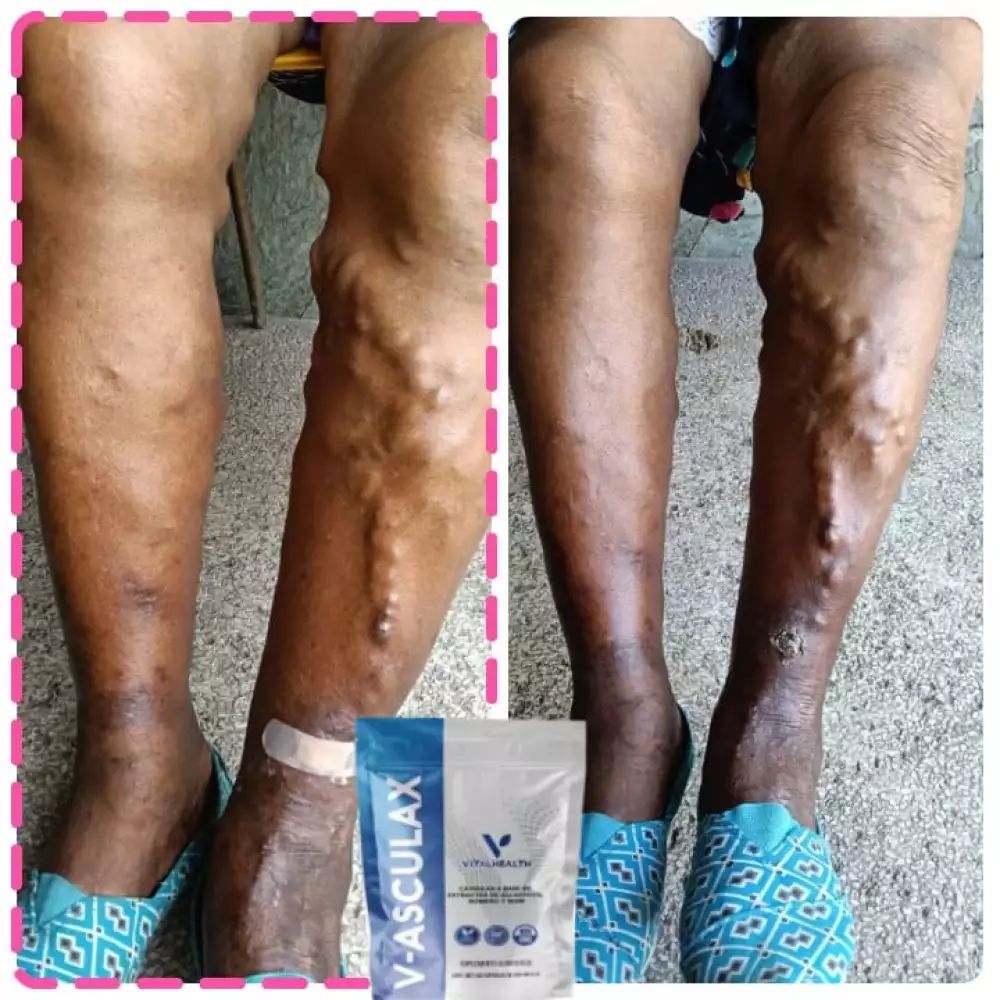 Vasculax 60 cápsulas para circulación y varices