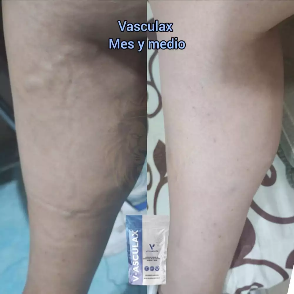 Vasculax 60 cápsulas para circulación y varices