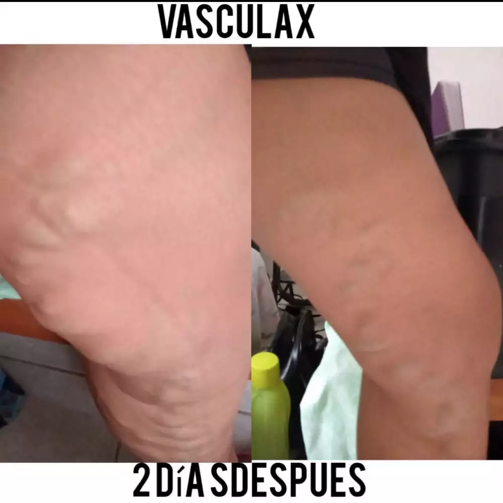 Vasculax 60 cápsulas para circulación y varices